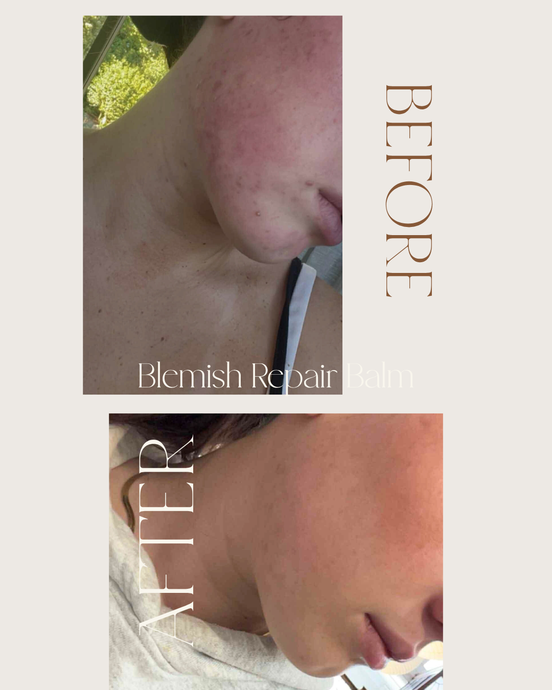 Teenskin Bundle
